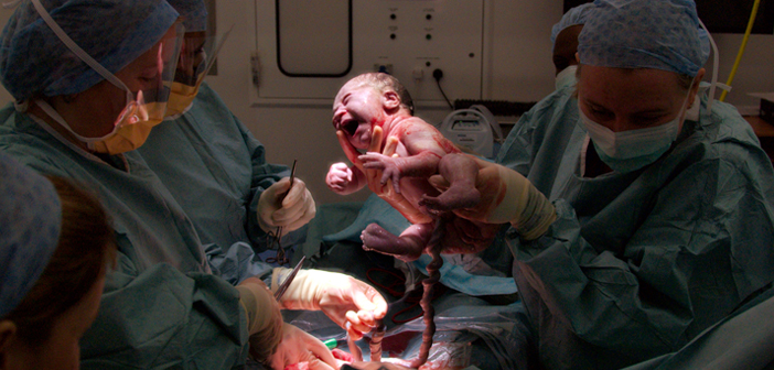 Doğum doğumdur, Sezaryen ise bir ameliyat!